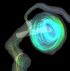 cfd streamlines